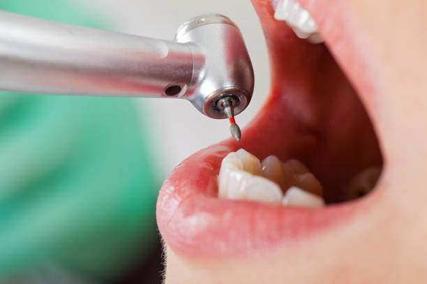 Best Emergency Care for Gum Disease in K I Sawyer, MI